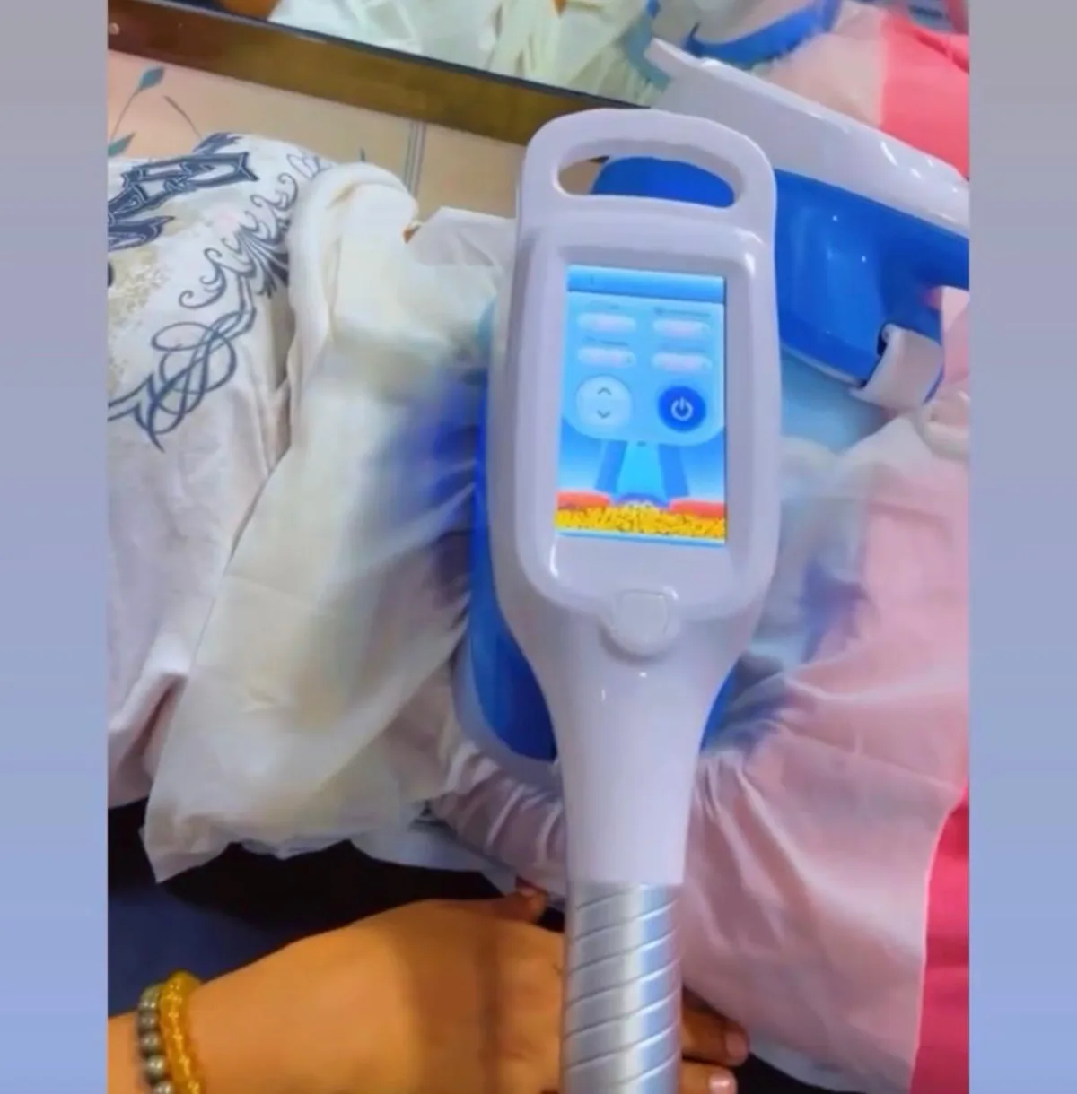 Cryo lipolysis at Dr. Tupe's Clinic
