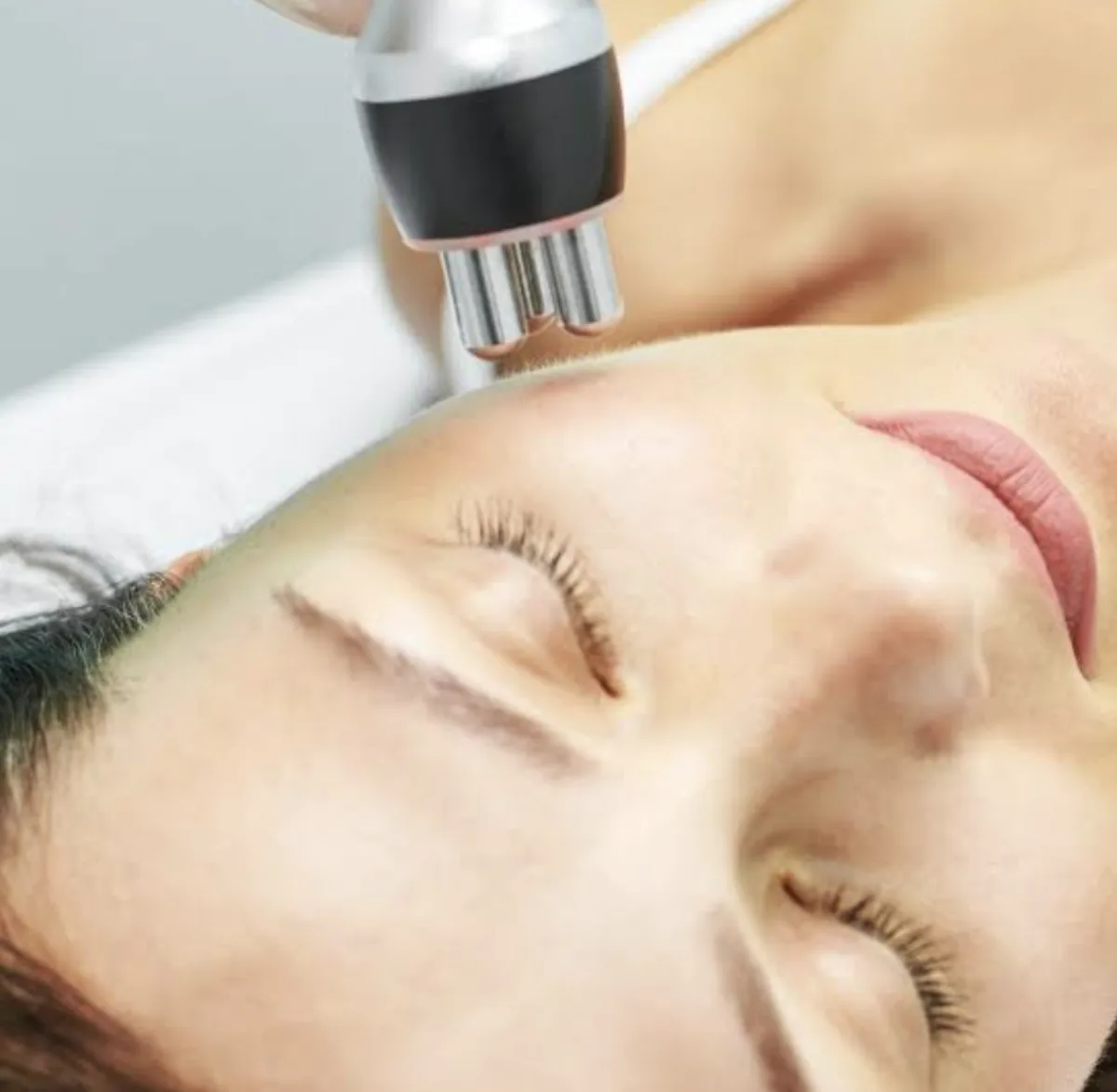 Radio frequency skin tightening at Dr. Tupe's Clinic